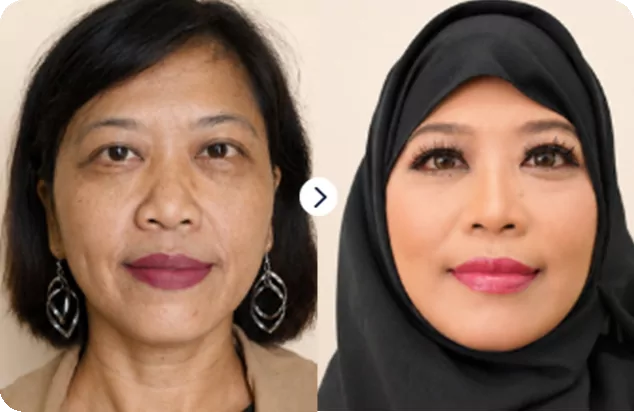 Ms Hai Tram — before and after