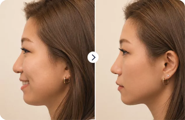 Ms To Mo Ai — before and after
