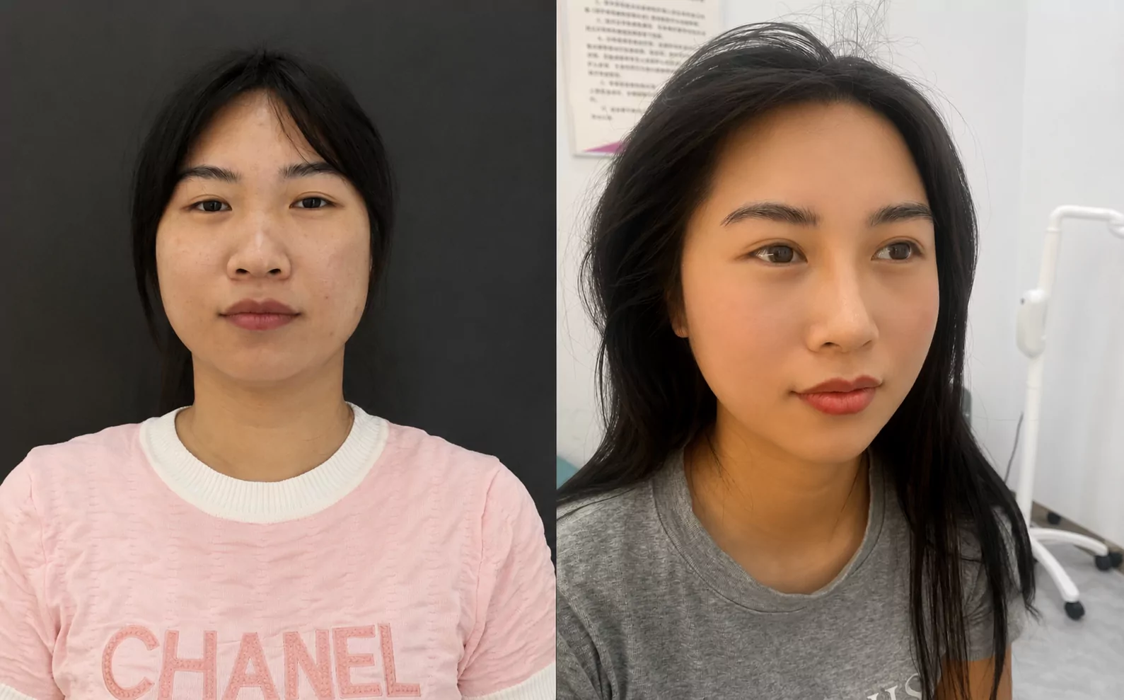 Ms Sari — before and after Tarik Wajah